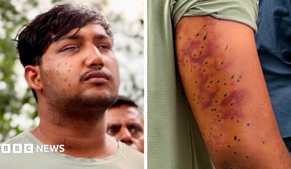 India's 'cockroach' protesters have wounds consistent with pellet-gun fire, say experts